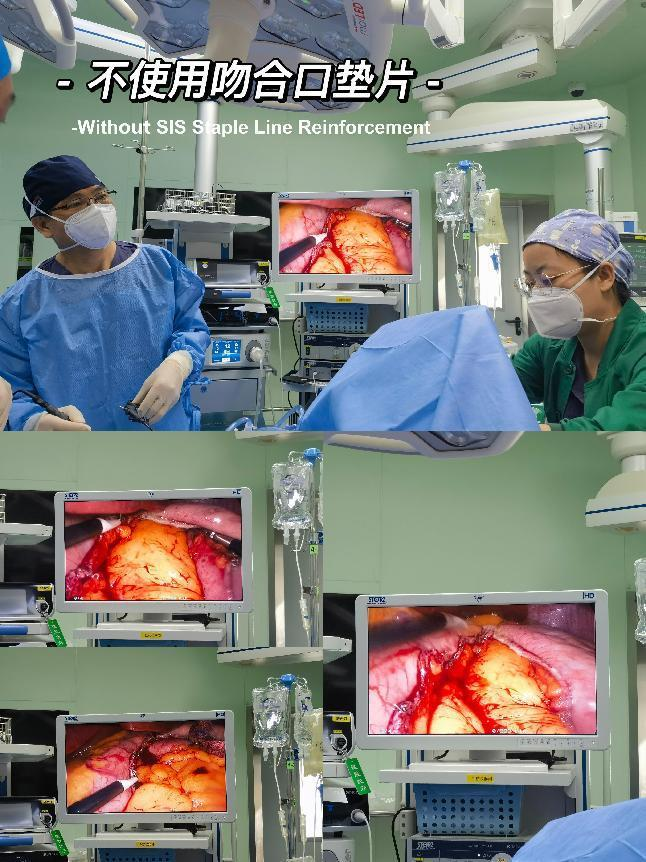 If the reinforcement will increase the cost of the total surgery