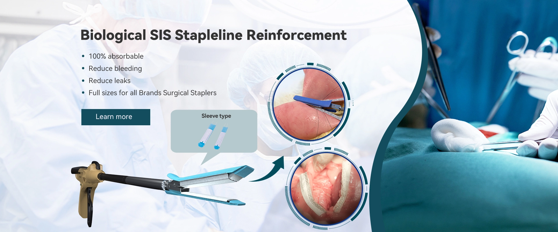 Biological SIS Stapleline Reinforcement