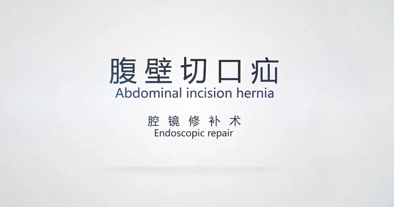 Abdonimal Incision Hernia Repair